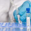 Alerta epidemiológico da OMS: Uso racional de testes de diagnóstico para COVID-19