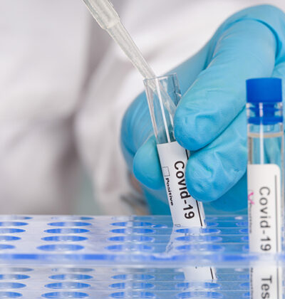 Alerta epidemiológico da OMS: Uso racional de testes de diagnóstico para COVID-19