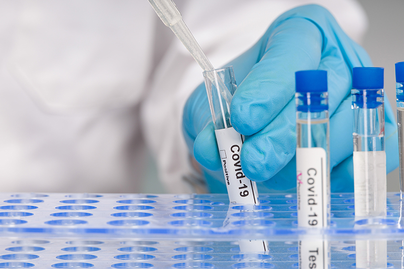 Alerta epidemiológico da OMS: Uso racional de testes de diagnóstico para COVID-19