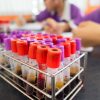 19ª Campanha Fique Sabendo mobiliza municípios paulistas para ampliar testagem de HIV e sífilis