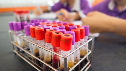 19ª Campanha Fique Sabendo mobiliza municípios paulistas para ampliar testagem de HIV e sífilis