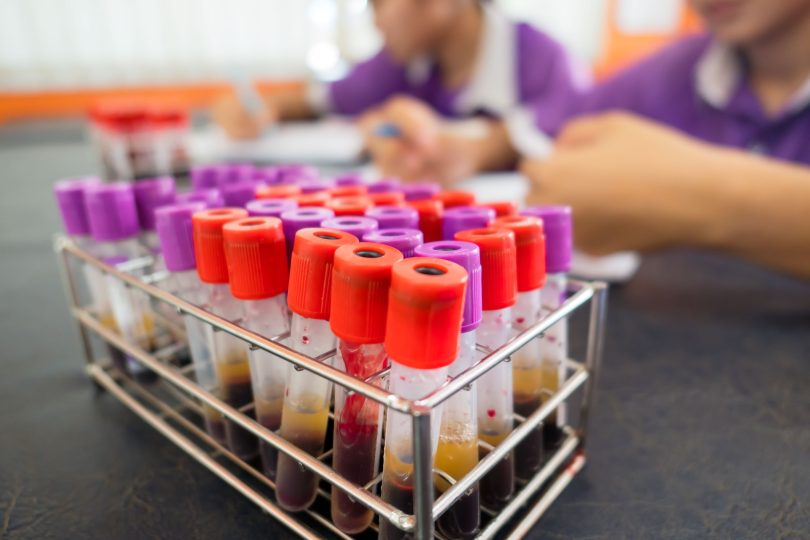 19ª Campanha Fique Sabendo mobiliza municípios paulistas para ampliar testagem de HIV e sífilis